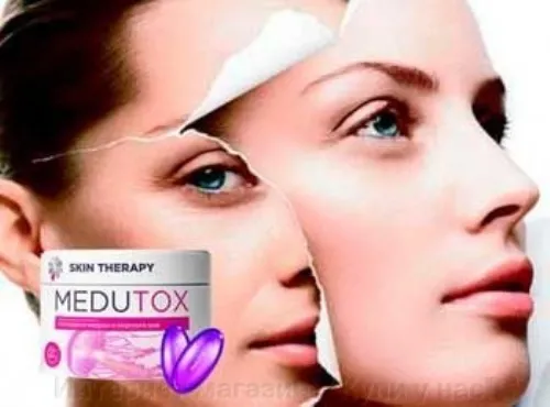 Elesse cream : kje kupiti v Sloveniji v lekarni?
